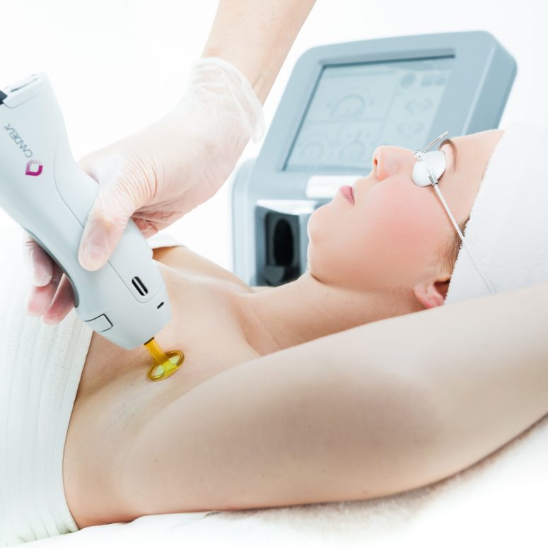 Common Myths and Misconceptions of Laser Hair Removal