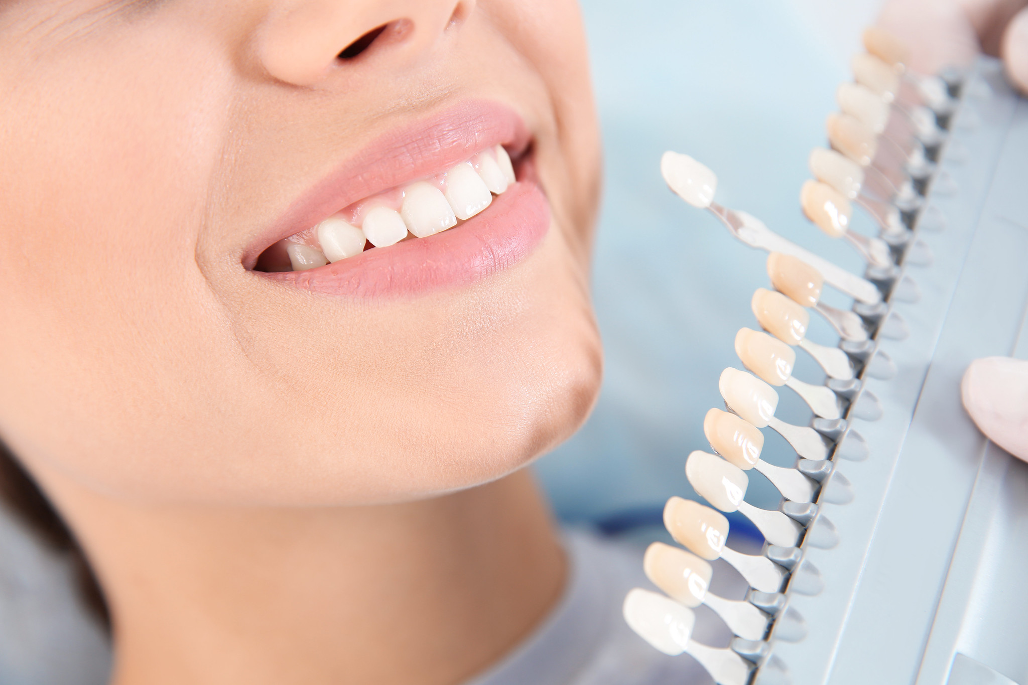 The Cost of Dental Implants, Veneers, Crowns, and Smile Makeovers What